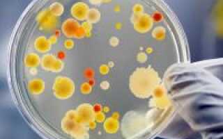 Какие болезнетворные бактерии бывают